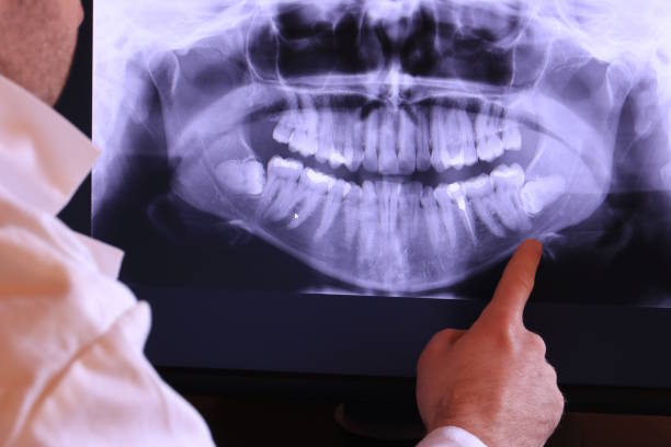 Best Emergency Tooth Extraction in Galva, IL